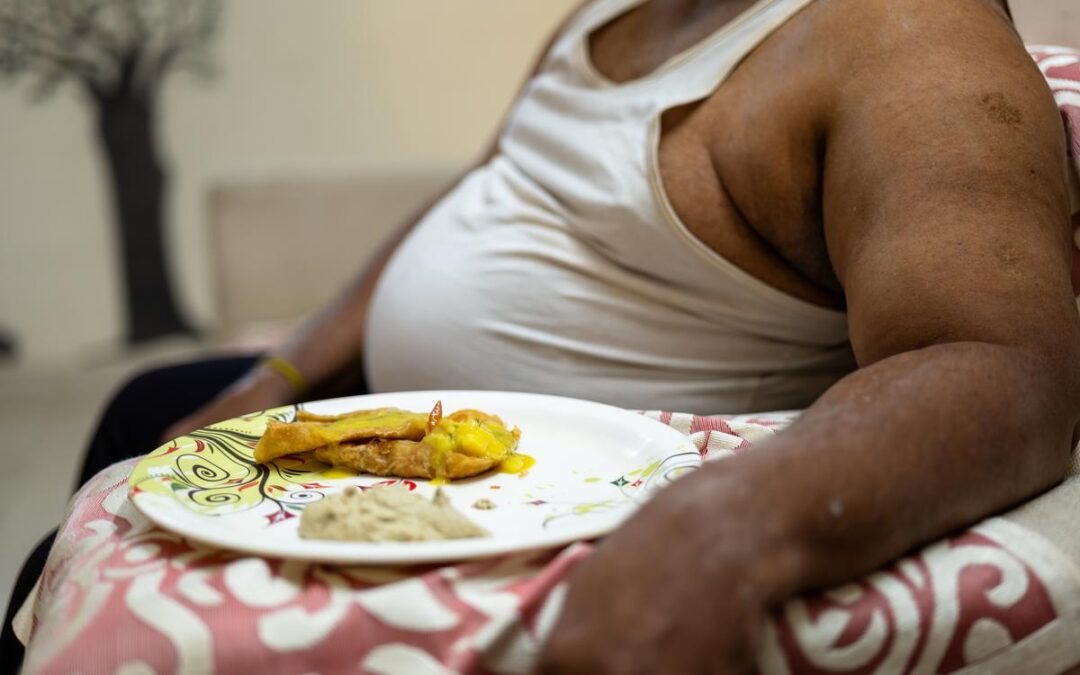 Burden of Rising Obesity of India: The Hefty Cost to Pay